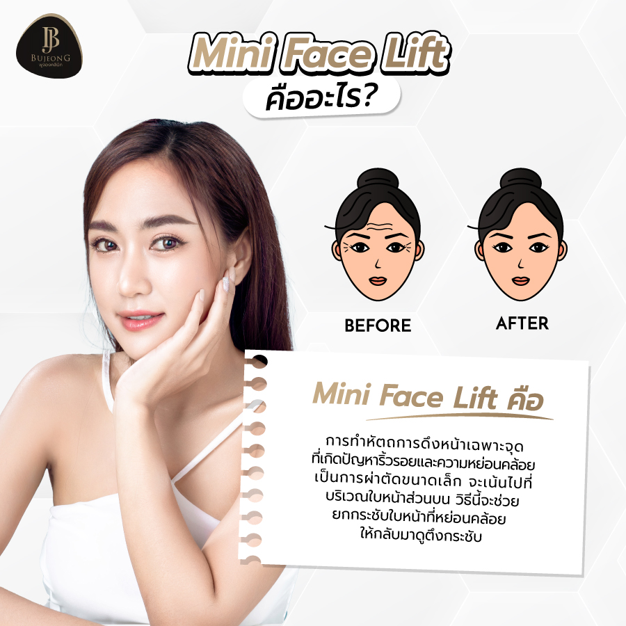 Mini Face Lift